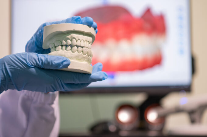 Crowded Teeth: Dealing With Consequences and Finding Solutions